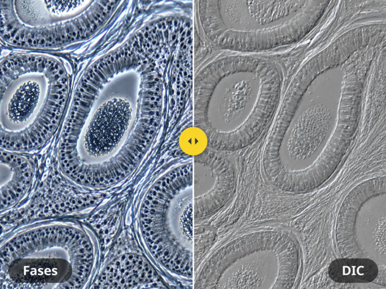 Contraste de la muestra en microscopía óptica